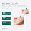 Anti Acne Face Serum - For Her - Coal Clean Beauty