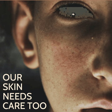 Male Skin Care - The Underdog On Rise - Coal Clean Beauty